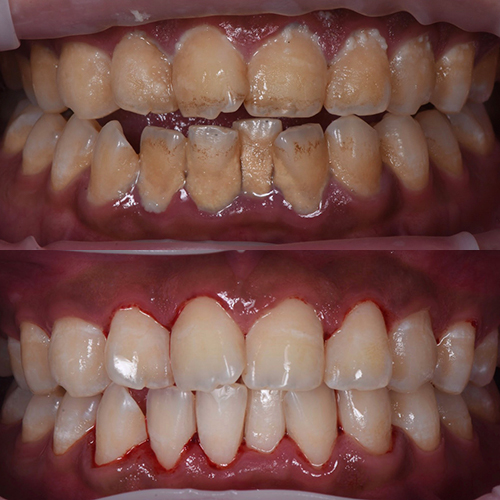 Before and After Dental Spa